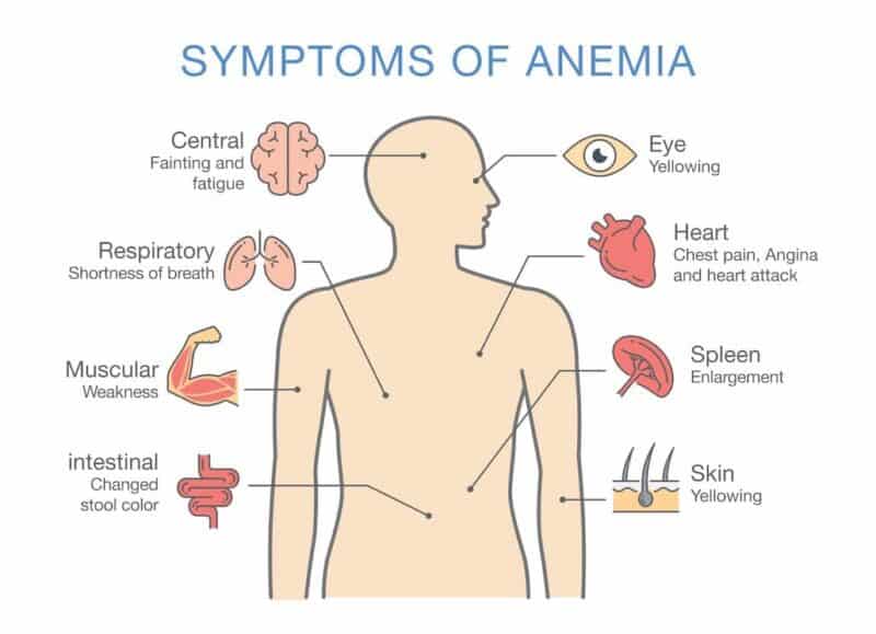 Anemia Solving An All Too Common Mystery Biodesign Wellness Center 2021