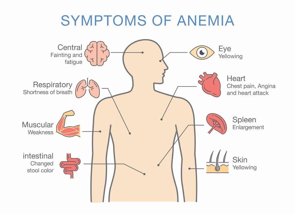 5 In 10 Women Suffers From Anemia In Gujarat Claims A Study DeshGujarat